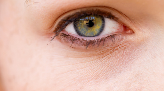Auge mit Falten